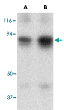 PAB13180 - ATF6 alpha