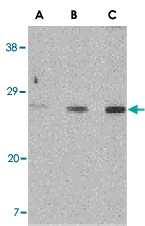 PAB13181 - XBP1 / TREB5