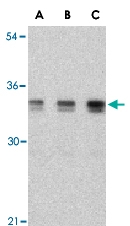 PAB13182 - XBP1 / TREB5