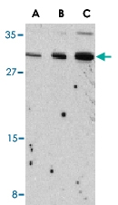 PAB13183 - Interleukin-31 / IL31