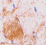 PAB13183 - Interleukin-31 / IL31