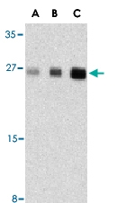 PAB13184 - Interleukin-31 / IL31