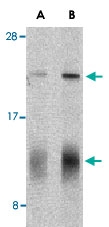 PAB13185 - Interleukin-32 / IL32