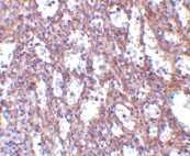 PAB13185 - Interleukin-32 / IL32