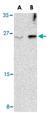 PAB13186 - Interleukin-32 / IL32