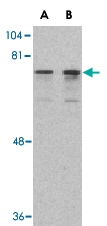 PAB13187 - DDX3X