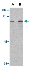 PAB13188 - DDX3X
