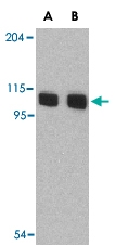 PAB13189 - AOF2