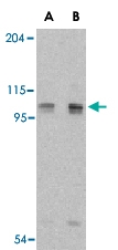 PAB13190 - AOF2