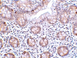 PAB13190 - AOF2