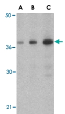 PAB13191 - SOCS1