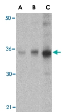PAB13192 - SOCS1