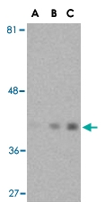 PAB13194 - Actin beta / ACTB