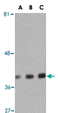 PAB13195 - GAPDH