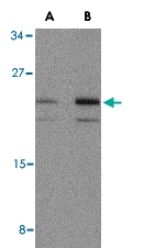PAB13198 - Interleukin-23 alpha / IL23A