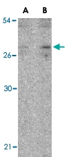PAB13199 - Interleukin-27 / IL27A