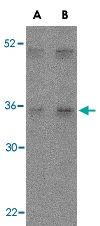 PAB13200 - Interleukin-27 / IL27A