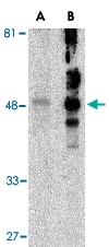 PAB13201 - TIMD1 / HAVCR1