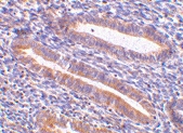 PAB13201 - TIMD1 / HAVCR1
