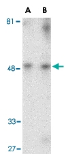PAB13202 - TIMD1 / HAVCR1