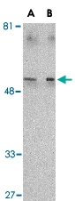 PAB13203 - TIMD4