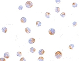 PAB13204 - TIMD4