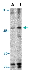 PAB13204 - TIMD4