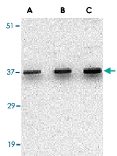 PAB13207 - Uracil-DNA glycosylase (UNG)