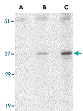 PAB13208 - Uracil-DNA glycosylase (UNG)