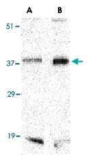 PAB13209 - BAG1