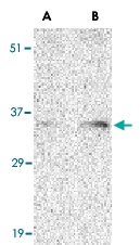 PAB13210 - BAG1