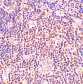 PAB13210 - BAG1