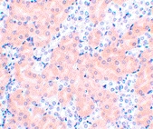 PAB13212 - Bcl-2-like 5