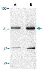 PAB13214 - TANK / ITRAF
