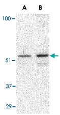 PAB13215 - TIP47 / M6PRBP1