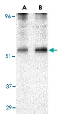 PAB13216 - TIP47 / M6PRBP1