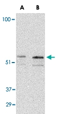 PAB13217 - PAK2