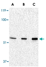 PAB13218 - PAK2