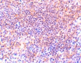 PAB13218 - PAK2