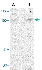 PAB13219 - TRPC3 / TRP3