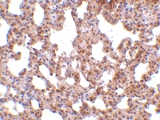 PAB13220 - TRPC6 / TRP6