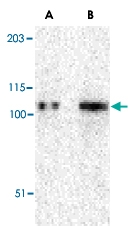 PAB13221 - TRPC6 / TRP6