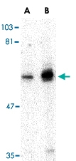PAB13223 - PTPN11 / PTP2C