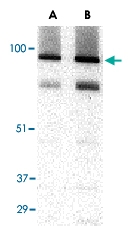 PAB13224 - TRPC3 / TRP3