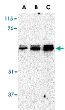 PAB13225 - EIF2AK2 / PKR
