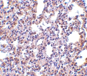 PAB13225 - EIF2AK2 / PKR