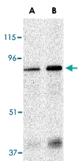 PAB13226 - EIF2AK2 / PKR