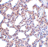 PAB13226 - EIF2AK2 / PKR