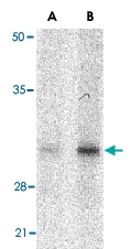 PAB13227 - SNAI2 / SLUG