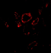 PAB13228 - SNAI2 / SLUG